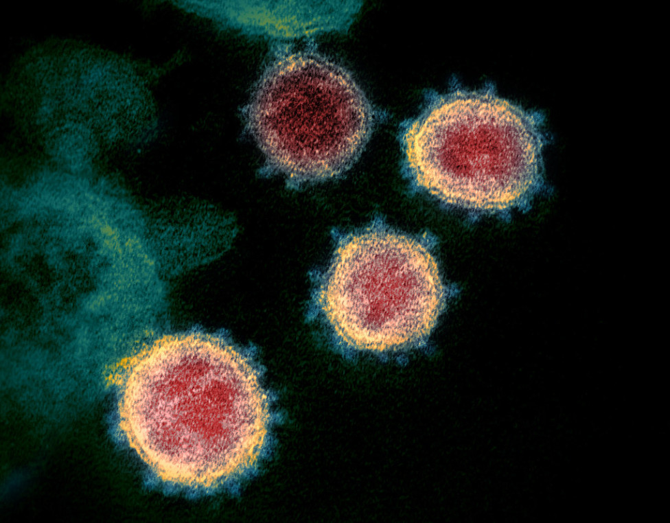 瑞士学者人工合成出新冠病毒，能在一周之内生产或改造出大量活病毒