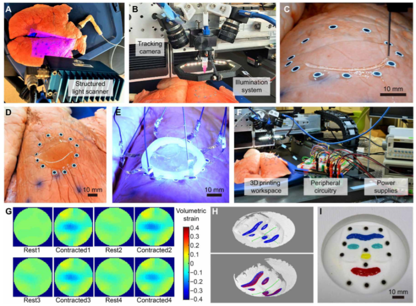 《Science》子刊：在活体器官上原位3D打印可变形水凝胶传感器！