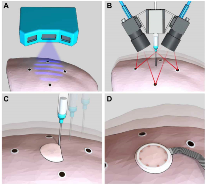 《Science》子刊：在活体器官上原位3D打印可变形水凝胶传感器！