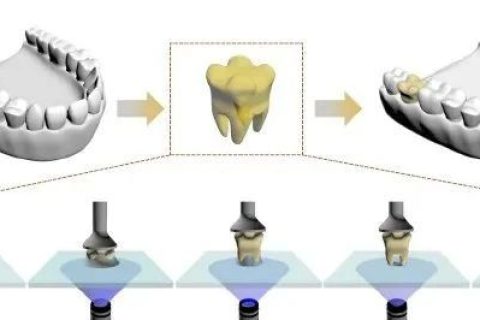 强大，一滴树脂就能打印一颗牙齿！中科院化学所实现单液滴3D打印技术
