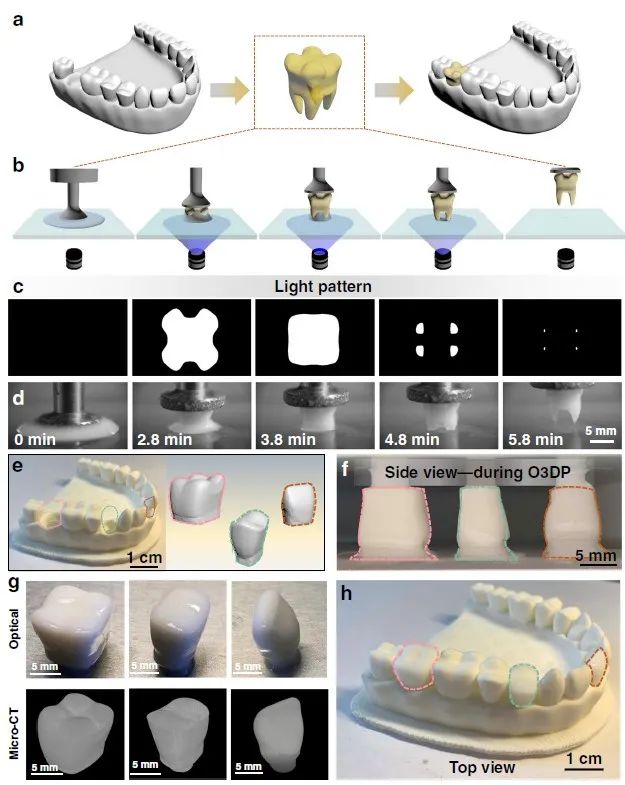 强大，一滴树脂就能打印一颗牙齿！《自然·通讯》：中科院化学所实现单液滴3D打印技术